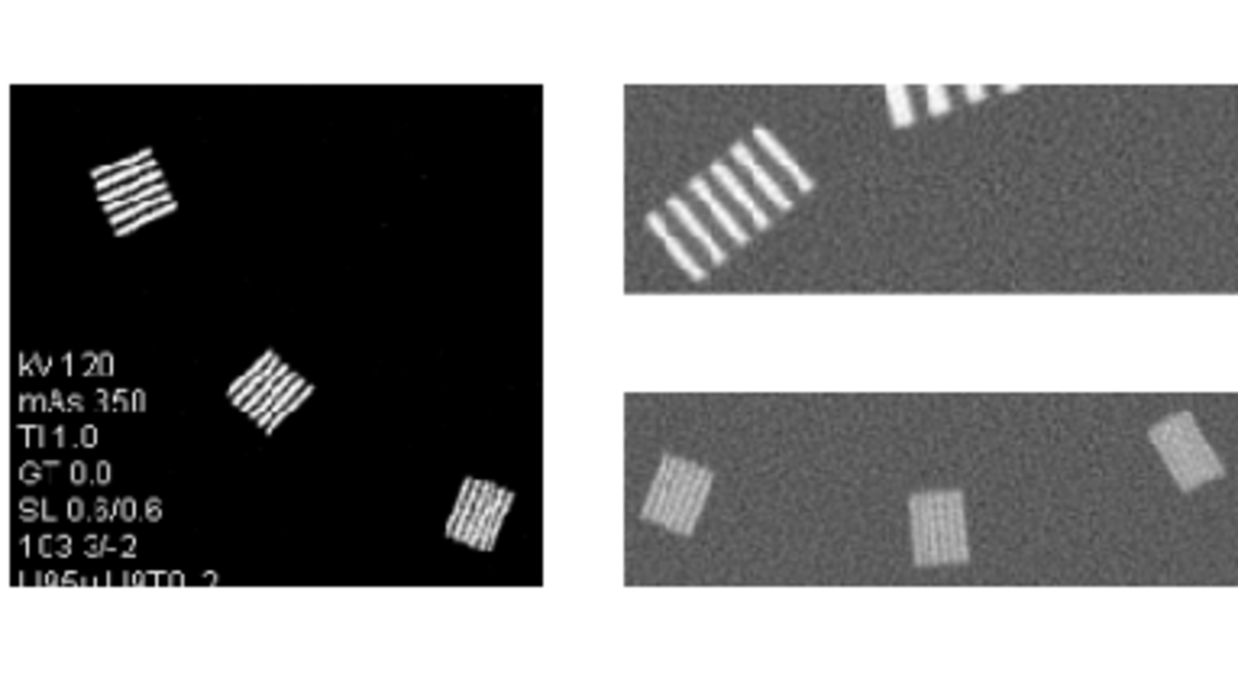 Examples of X-ray CT-scans